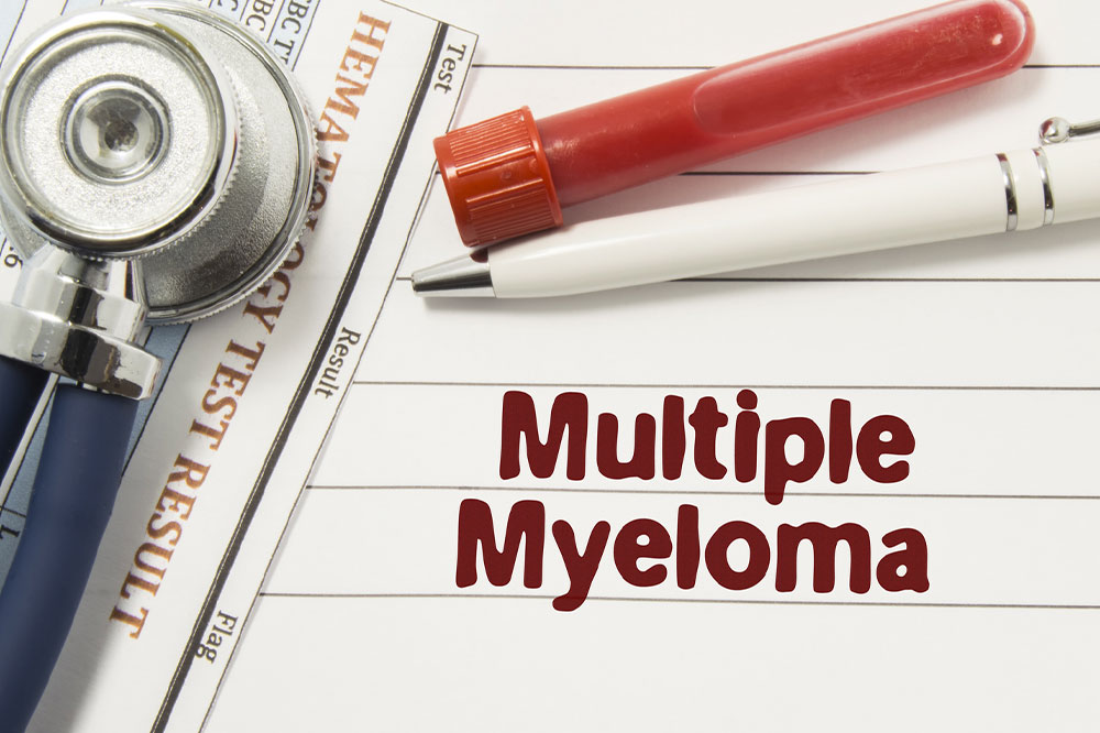 7 Warning Signs and Symptoms of Multiple Myeloma